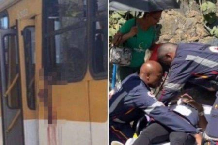 Passageira amputa o braço após tentativa de ‘Selfie’ em ônibus de Salvador