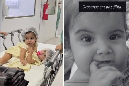 Gêmea siamesa morre após cirurgia de separação em Goiânia