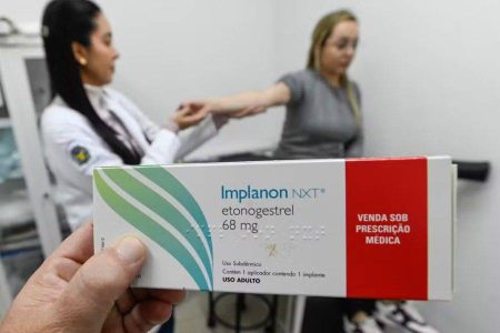 Planos de saúde passam a cobrir implante contraceptivo Implanon