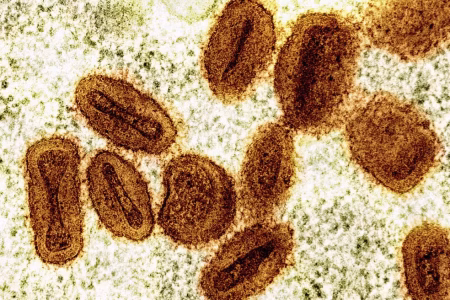 Dois casos de Mpox são confirmados na Bahia