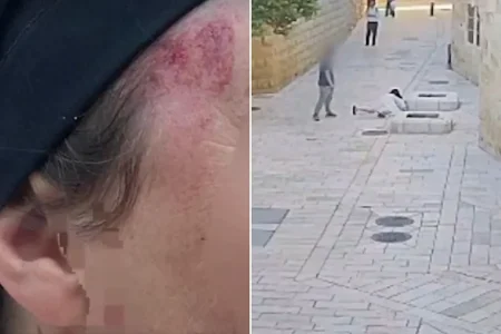 VÍDEO: Freira é atacada pelas costas e agressor é preso; entenda