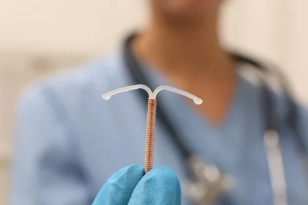 DIU hormonal para endometriose passa a ter cobertura obrigatória pelos planos de saúde